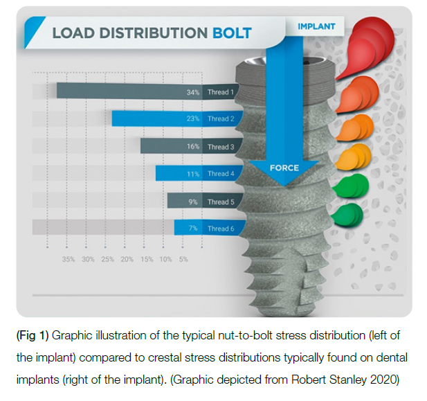 (Fig 1) Graphic illustration of the typical nut-to-bolt stress distribution (left of the implant) compared to crestal stress distributions typically found on dental implants (right of the implant). (Graphic depicted from Robert Stanley 2020)